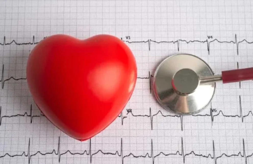Rappresentazione grafica del battito cardiaco irregolare su elettrocardiogramma, tipico delle aritmie cardiache