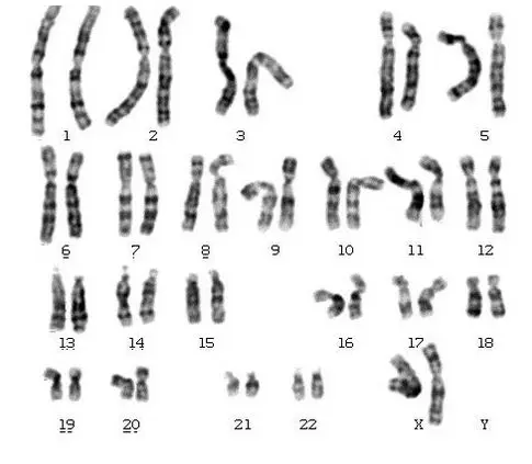 Analisi citogenetica: immagine introduttiva