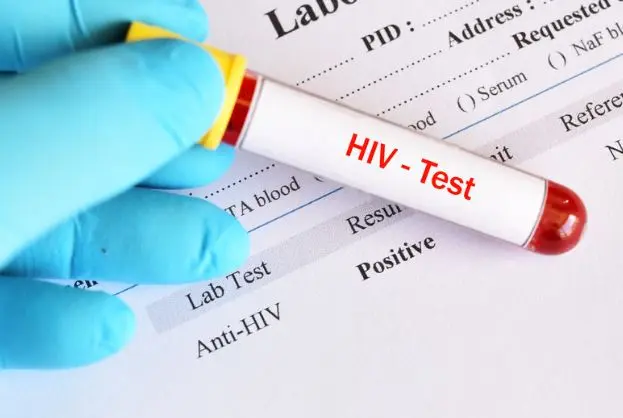 Anticorpi Anti-HIV: immagine introduttiva