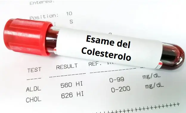 Esame del Colesterolo: immagine introduttiva