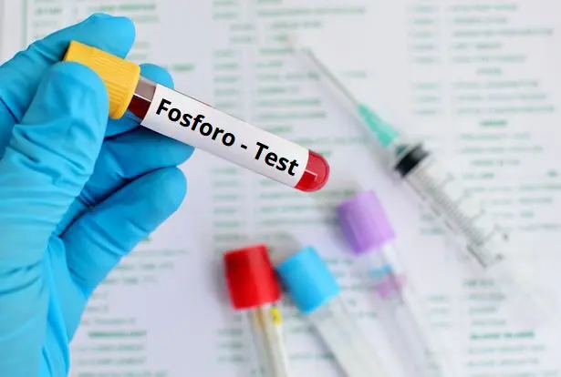 Esame del Fosforo: immagine introduttiva