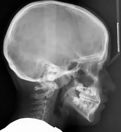 Teleradiografia del Cranio: immagine introduttiva