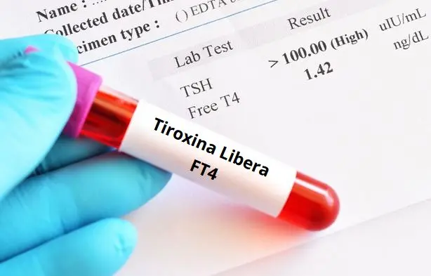 Tiroxina Libera (FT4): immagine introduttiva